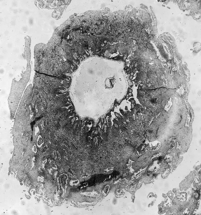 Framed Print : Human Reproduction, Ovum, TEM Framed Print : Human Reproduction, Ovum, TEM