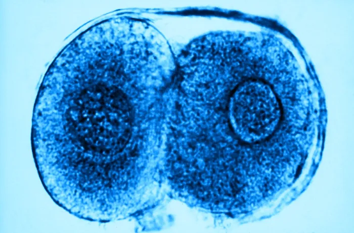Framed Print : Human Reproduction, Ovum, Zygote Cell Stage, TEM