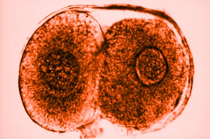 Framed Print : Human Reproduction, Ovum, Zygote Cell Stage, TEM Framed Print : Human Reproduction, Ovum, Zygote Cell Stage, TEM
