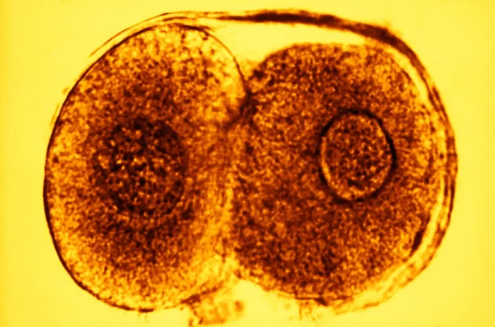 Framed Print : Human Reproduction, Ovum, Zygote Cell Stage, TEM
