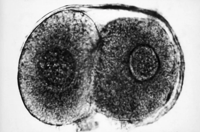 Framed Print : Human Reproduction, Ovum, Zygote Cell Stage, TEM Framed Print : Human Reproduction, Ovum, Zygote Cell Stage, TEM