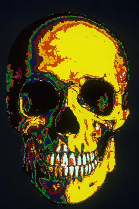 Framed Print : Human Skull