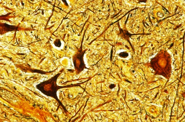 Framed Print : Human spinal cord Nerve tissue under a microscope Framed Print : Human spinal cord Nerve tissue under a microscope