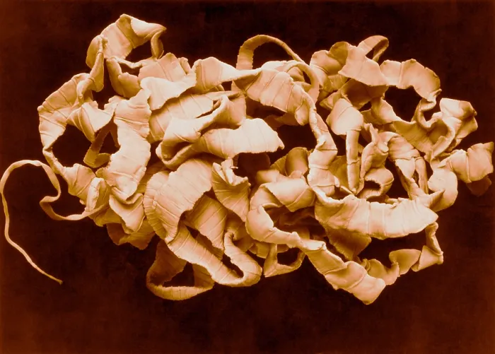 Framed Print : Human Tapeworm, gross specimen Framed Print : Human Tapeworm, gross specimen