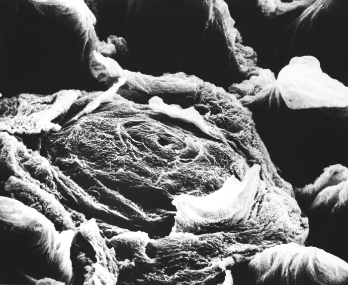 Framed Print : Human tongue papilla, under a microscope (SEM) Framed Print : Human tongue papilla, under a microscope (SEM)