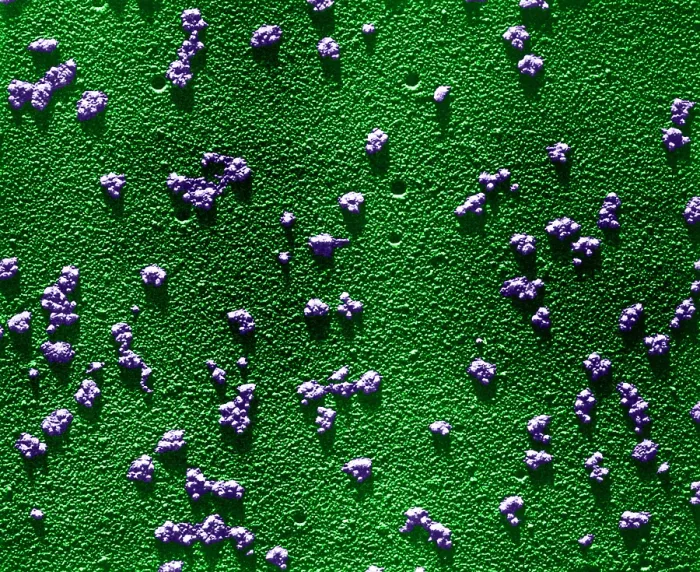 Framed Print : Immature RBCs, Reticulocyte Polyribosomes, TEM Framed Print : Immature RBCs, Reticulocyte Polyribosomes, TEM