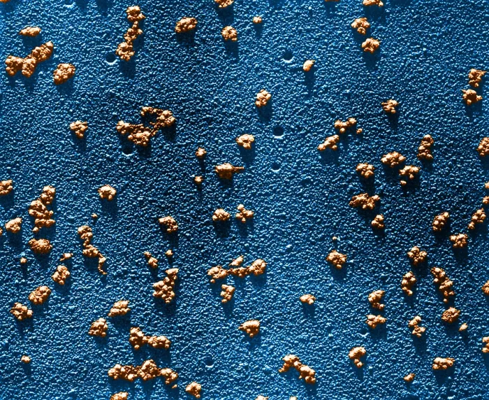 Framed Print : Immature RBCs, Reticulocyte Polyribosomes, TEM Framed Print : Immature RBCs, Reticulocyte Polyribosomes, TEM
