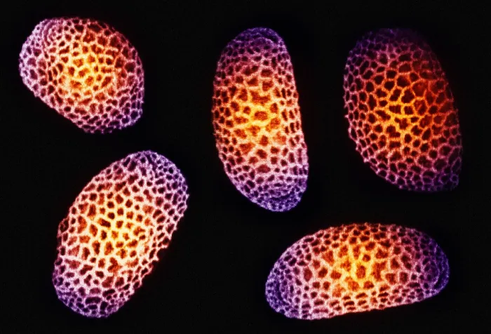 Framed Print : Impatiens Pollen Grains Framed Print : Impatiens Pollen Grains