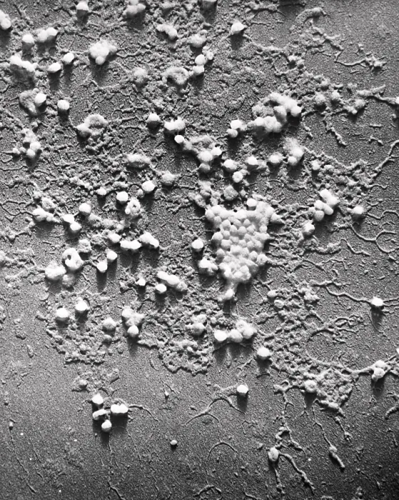 Framed Print : Influenza B Framed Print : Influenza B