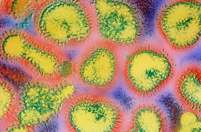 Framed Print : Influenza (TEM) Framed Print : Influenza (TEM)
