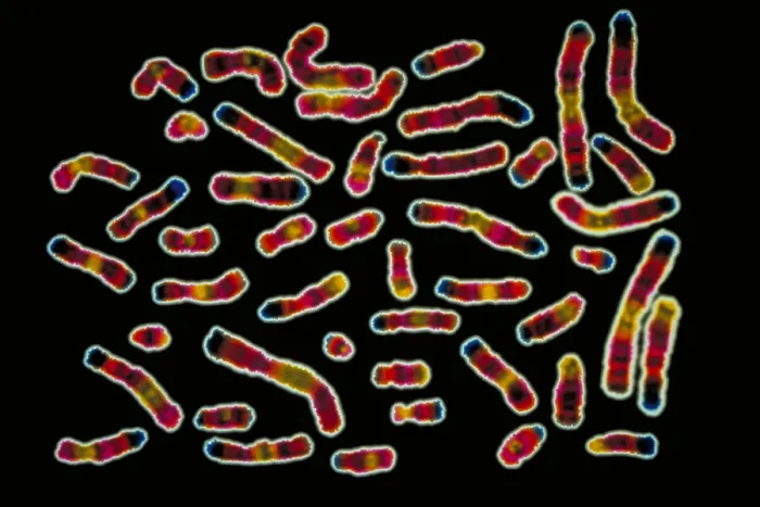 Framed Print : Karyotype of human chromosomes