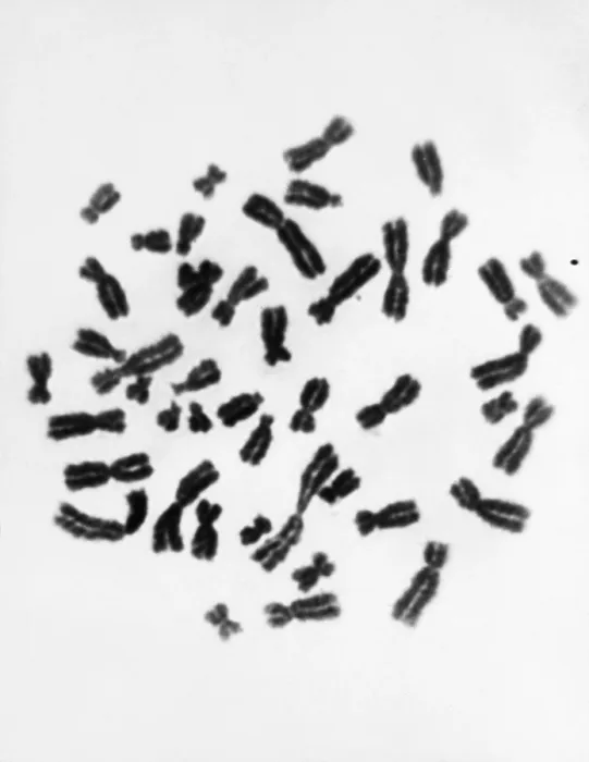 Framed Print : Karyotype, Normal Female Chromosomes Framed Print : Karyotype, Normal Female Chromosomes