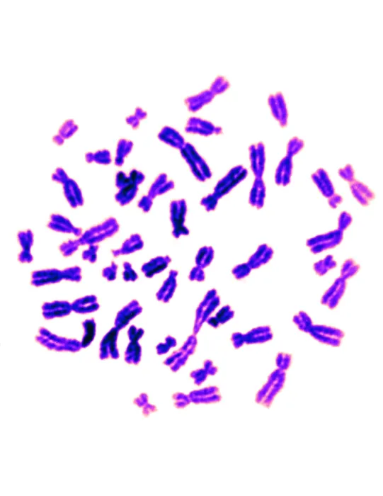 Framed Print : Karyotype, Normal Female Chromosomes Framed Print : Karyotype, Normal Female Chromosomes