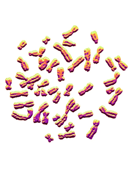 Framed Print : Karyotype, Normal Female Chromosomes Framed Print : Karyotype, Normal Female Chromosomes