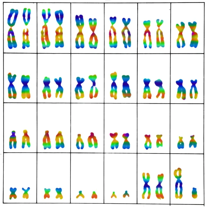 Framed Print : Karyotype, Normal Male Chromosomes Framed Print : Karyotype, Normal Male Chromosomes
