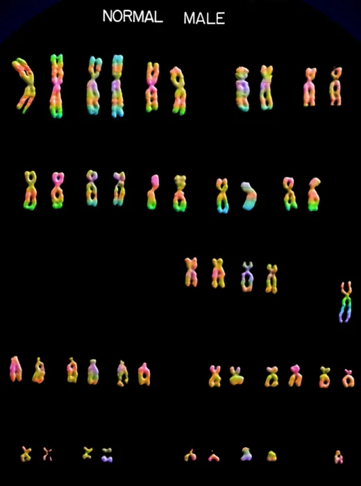 Framed Print : Karyotype, Normal Male Chromosomes