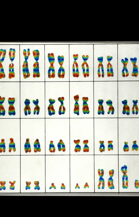 Framed Print : Karyotype, Normal Male Chromosomes Framed Print : Karyotype, Normal Male Chromosomes