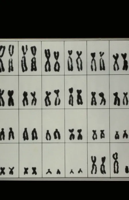 Framed Print : Karyotype, Normal Male Chromosomes Framed Print : Karyotype, Normal Male Chromosomes