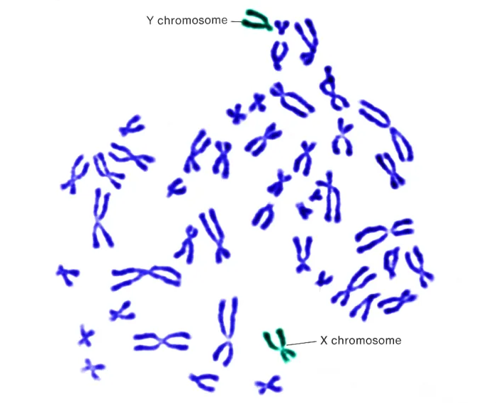 Framed Print : Karyotype, Normal Male Chromosomes Framed Print : Karyotype, Normal Male Chromosomes