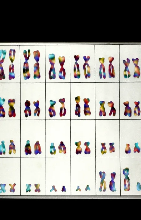 Framed Print : Karyotype, Normal Male Chromosomes Framed Print : Karyotype, Normal Male Chromosomes