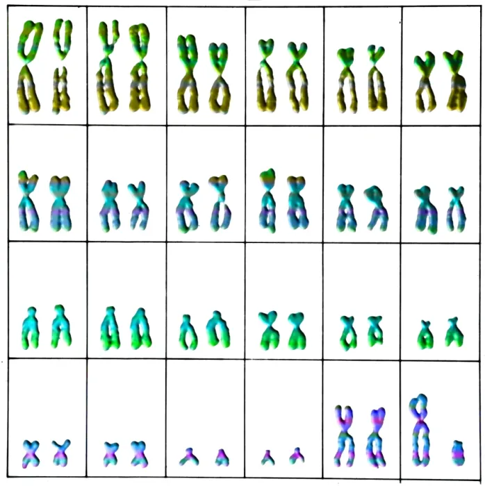 Framed Print : Karyotype, Normal Male Chromosomes Framed Print : Karyotype, Normal Male Chromosomes