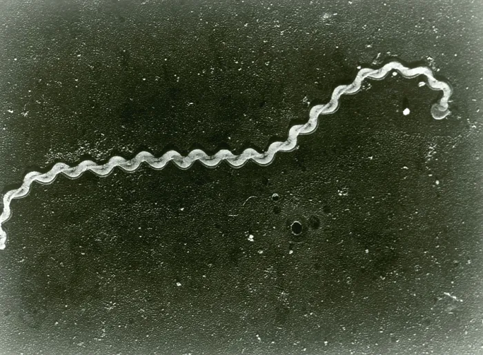 Framed Print : Leptospira Bacteria, under a microscope (SEM) Framed Print : Leptospira Bacteria, under a microscope (SEM)