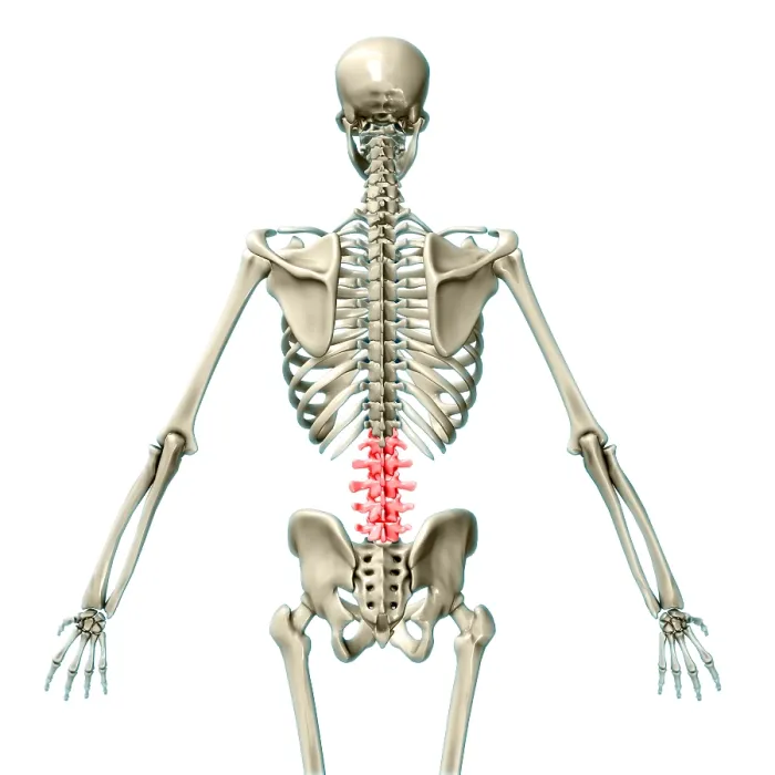 Framed Print : Lumbar Vertebrae, Illustration Framed Print : Lumbar Vertebrae, Illustration