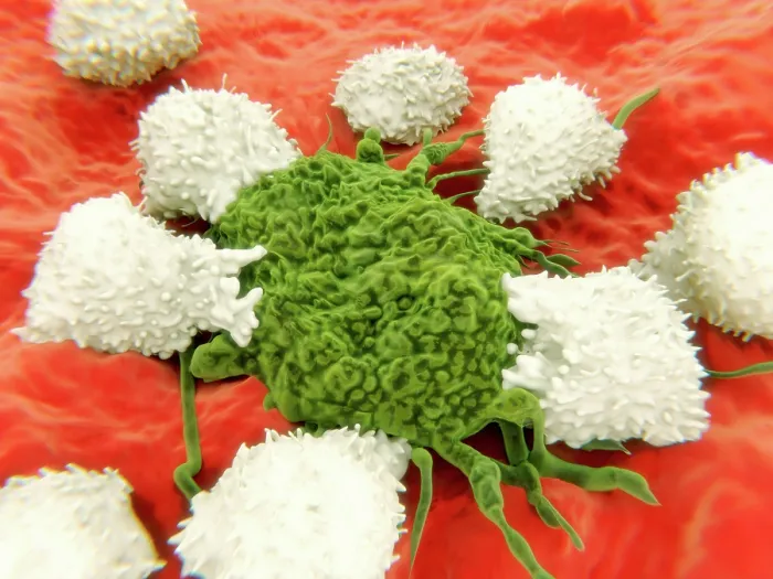 Framed Print : Lymphocytes and cancer cell Framed Print : Lymphocytes and cancer cell