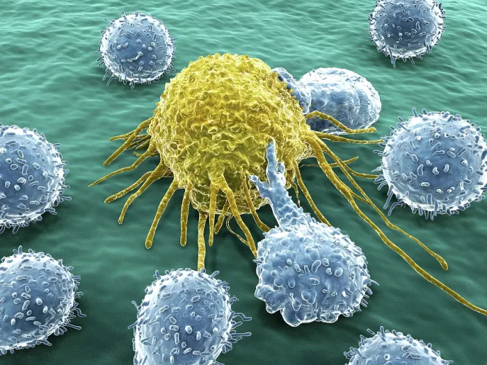 Framed Print : Lymphocytes and cancer cell