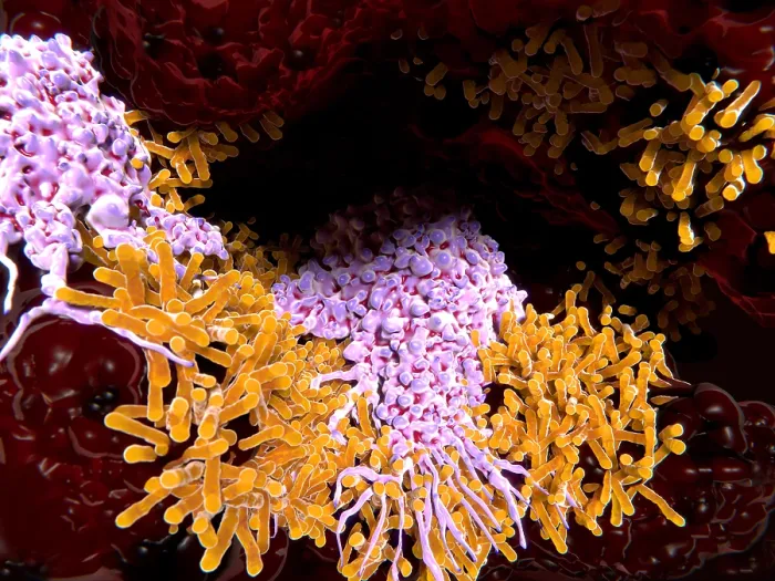 Framed Print : Macrophages engulfing tuberculosis bacillus in the lungs