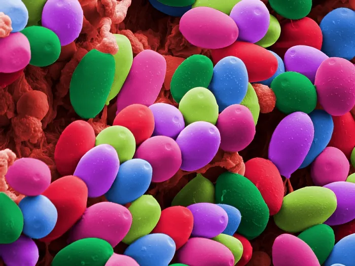 Framed Print : Magic Mushroom Spores, under a microscope (SEM) Framed Print : Magic Mushroom Spores, under a microscope (SEM)