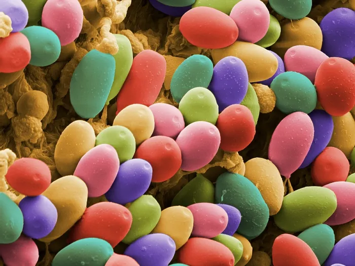 Framed Print : Magic Mushroom Spores, under a microscope (SEM) Framed Print : Magic Mushroom Spores, under a microscope (SEM)