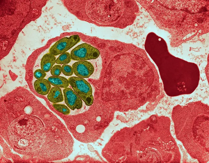 Framed Print : Malaria parasite, Plasmodium cathemerium, inside a blood cell, under an electron microscope, TEM Framed Print : Malaria parasite, Plasmodium cathemerium, inside a blood cell, under an electron microscope, TEM