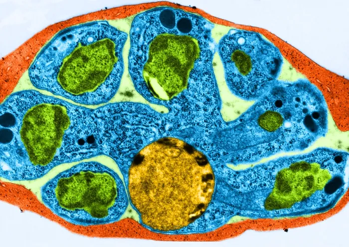 Framed Print : Malaria, Plasmodium cathemerium, TEM Framed Print : Malaria, Plasmodium cathemerium, TEM
