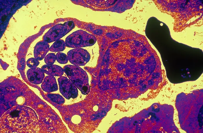 Framed Print : Malaria, Plasmodium cathemerium, TEM Framed Print : Malaria, Plasmodium cathemerium, TEM