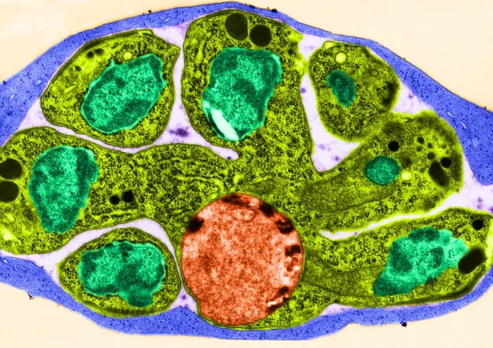 Framed Print : Malaria, Plasmodium cathemerium, TEM Framed Print : Malaria, Plasmodium cathemerium, TEM