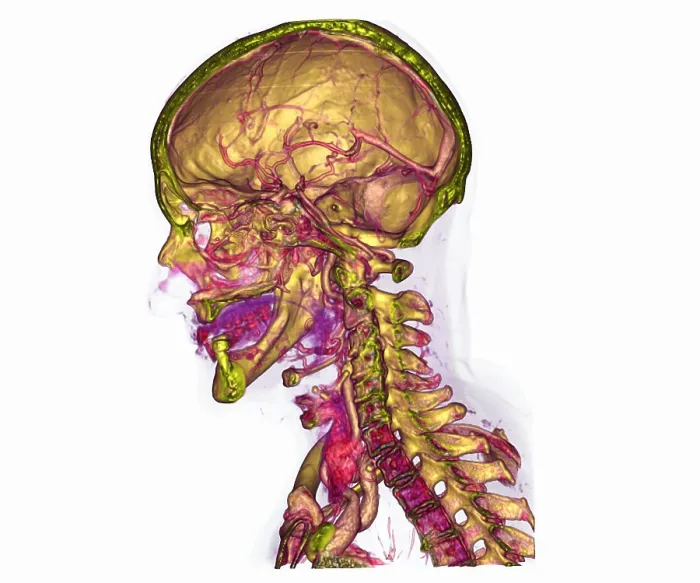 Framed Print : Male Skull & Arterial System Framed Print : Male Skull & Arterial System