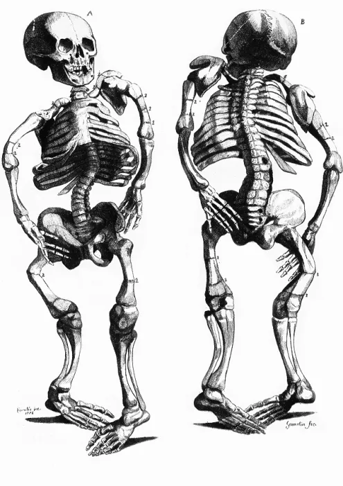 Framed Print : Malformed Skeletons