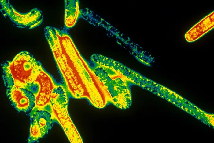 Framed Print : Marburg Virus (TEM) Framed Print : Marburg Virus (TEM)