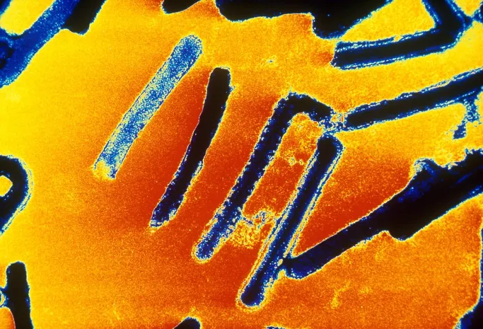 Framed Print : Marburg Virus (TEM) Framed Print : Marburg Virus (TEM)