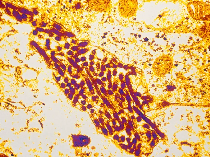 Framed Print : Marburg Virus (TEM) Framed Print : Marburg Virus (TEM)
