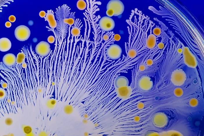 Framed Print : Marine Actinomycetes