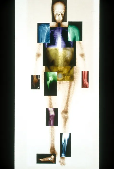 Framed Print : Medical Imaging Montage
