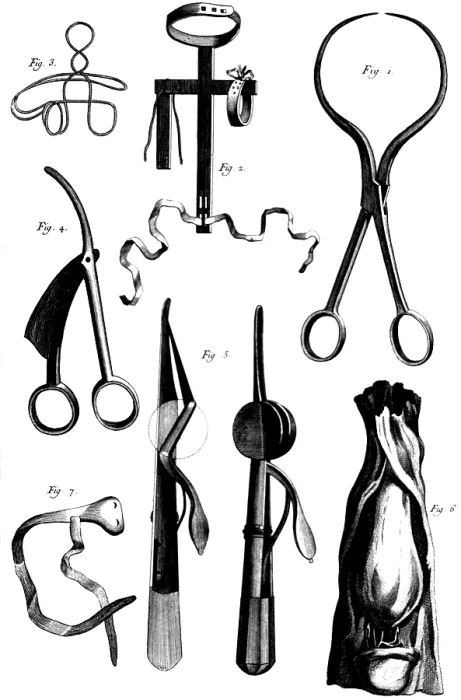 Framed Print : Medical Instruments, 18th Century Framed Print : Medical Instruments, 18th Century