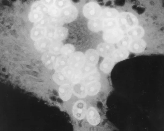Framed Print : MeV, Measles Virus, TEM Framed Print : MeV, Measles Virus, TEM