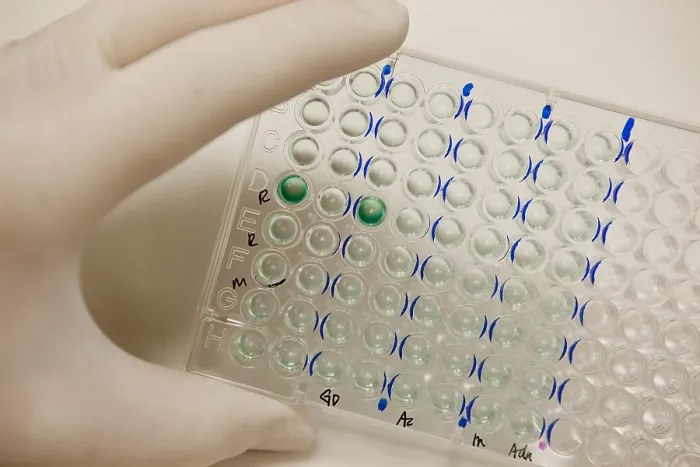 Framed Print : Microtiter Plate