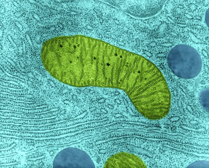 Framed Print : Mitochondrion in Bat Pancreas Cell, TEM Framed Print : Mitochondrion in Bat Pancreas Cell, TEM