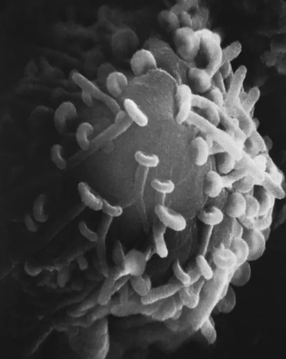 Framed Print : Motor Nerve, Synapses, under a microscope (SEM) Framed Print : Motor Nerve, Synapses, under a microscope (SEM)