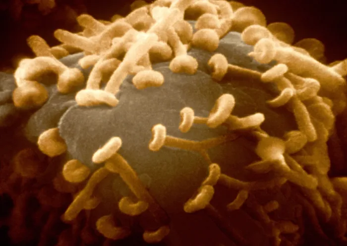 Framed Print : Motor Nerve, Synapses, under a microscope (SEM) Framed Print : Motor Nerve, Synapses, under a microscope (SEM)