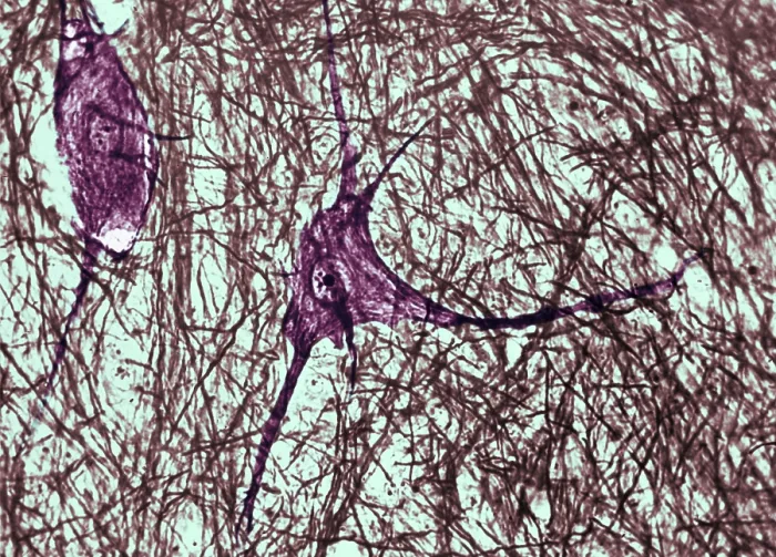 Framed Print : Motor Neuron, TEM Framed Print : Motor Neuron, TEM